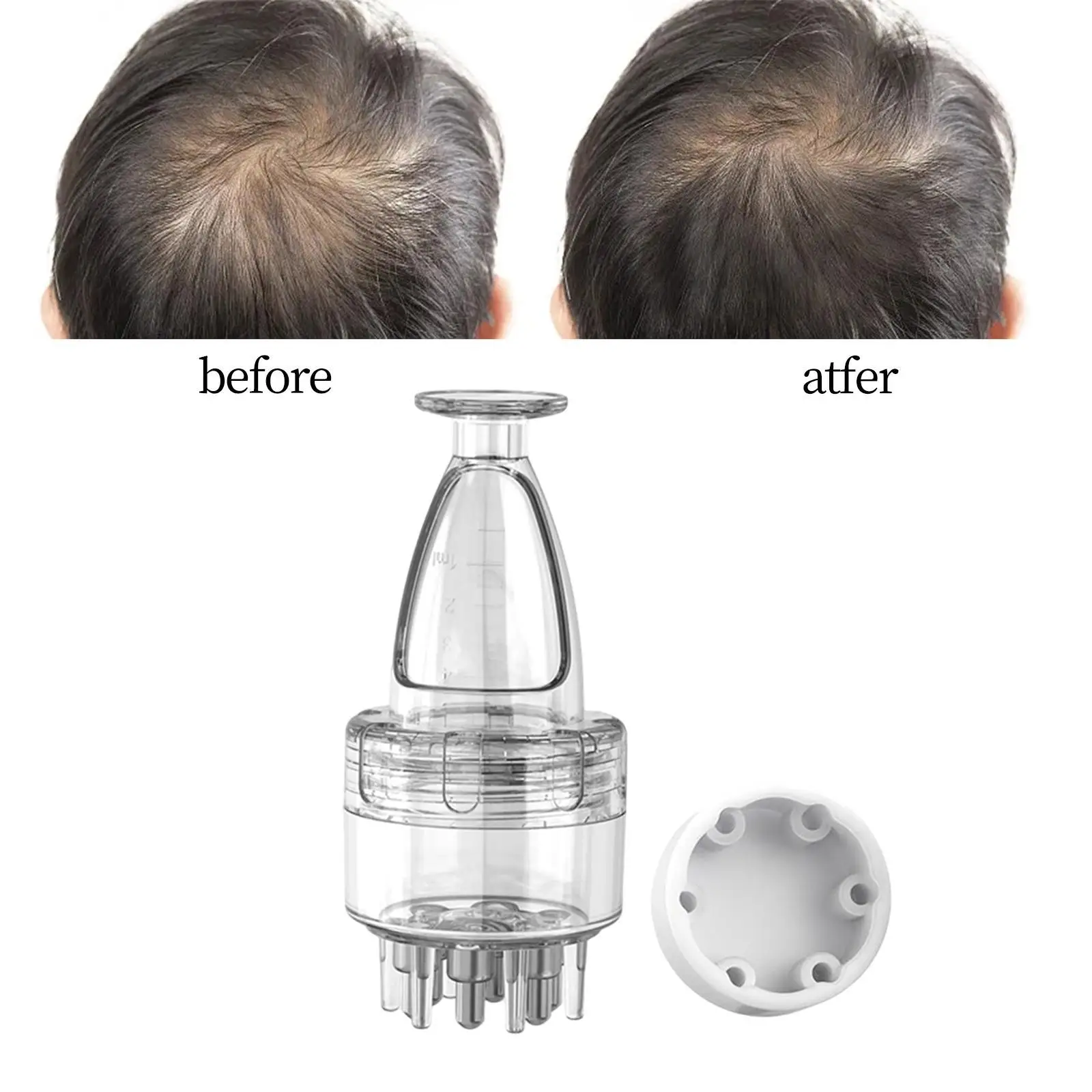 Scalp Applicator Ball Comb Applicator ขวดสําหรับ Home Travel ผู้หญิงผู้ชาย