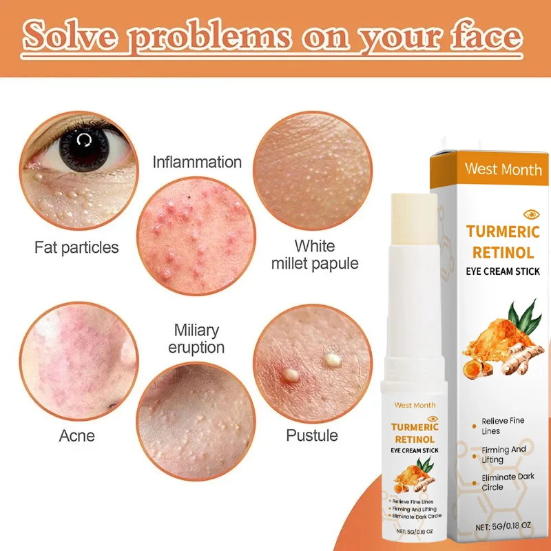 حبيبات الدهون إزالة كريم عين عصا ميليا علاج منتجات إصلاح العين المضادة للالتهابات المضادة للانتفاخ العناية بالبشرة الكورية #4