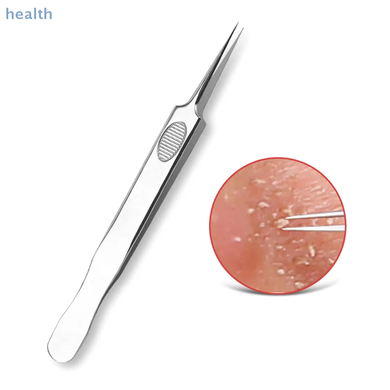 Pincettes à Clip pour points noirs, modèle Ultra-fin antidérapant, beauté du visage, santé, spécial dissolvant de points noirs, outil d'aiguille pour l'acné, 1 pièces