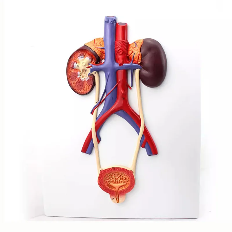 

Bladder Catheterization, Kidney And Urinary System Anatomy Model, Human Arteriovenous Model Medicine Teaching Supplies