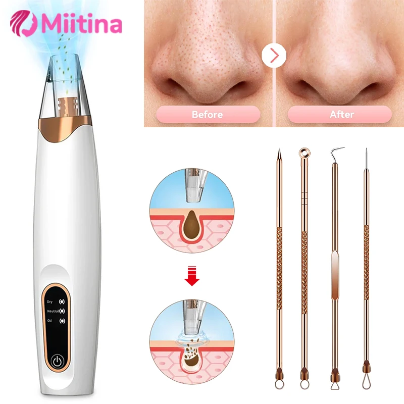 Electric Blackhead Remover Vacuum Face Pore Cleaner Whiteheads Black Spots Pimple Acne Extractor Skin Care Set USB Rechargeable