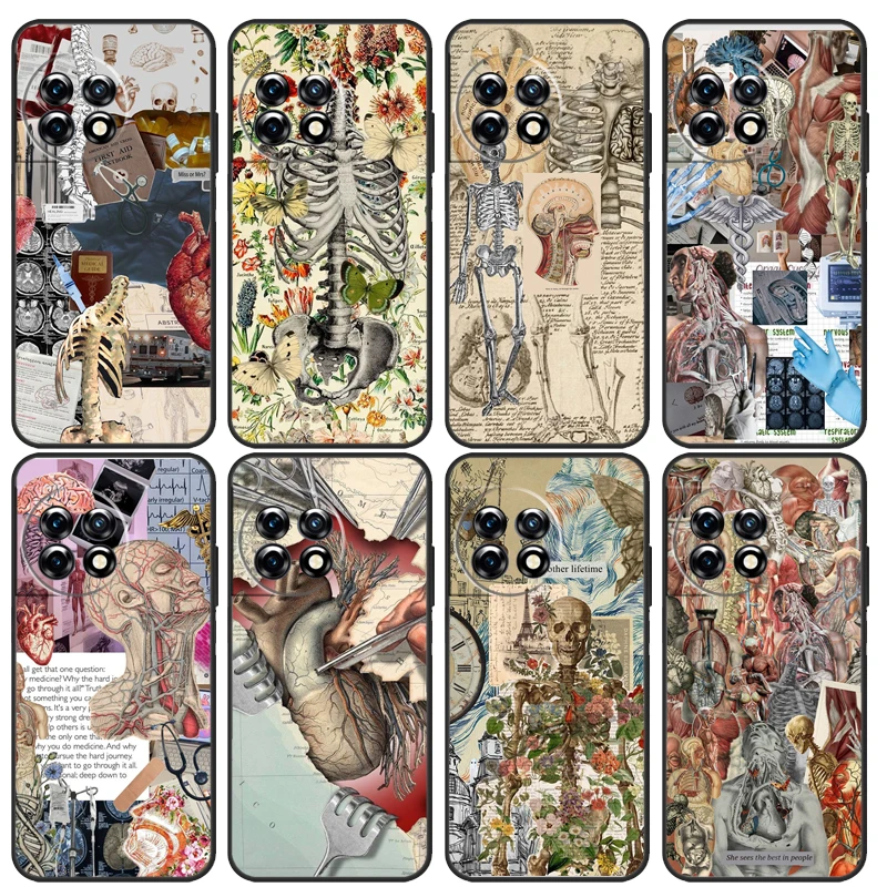 Human Organs Brain Kidney Medical Case For OnePlus 11 10T 10R 8T 8 9 10 Pro Cover For OnePlus Nord 3 2T CE 2 Lite N10 N20 N30