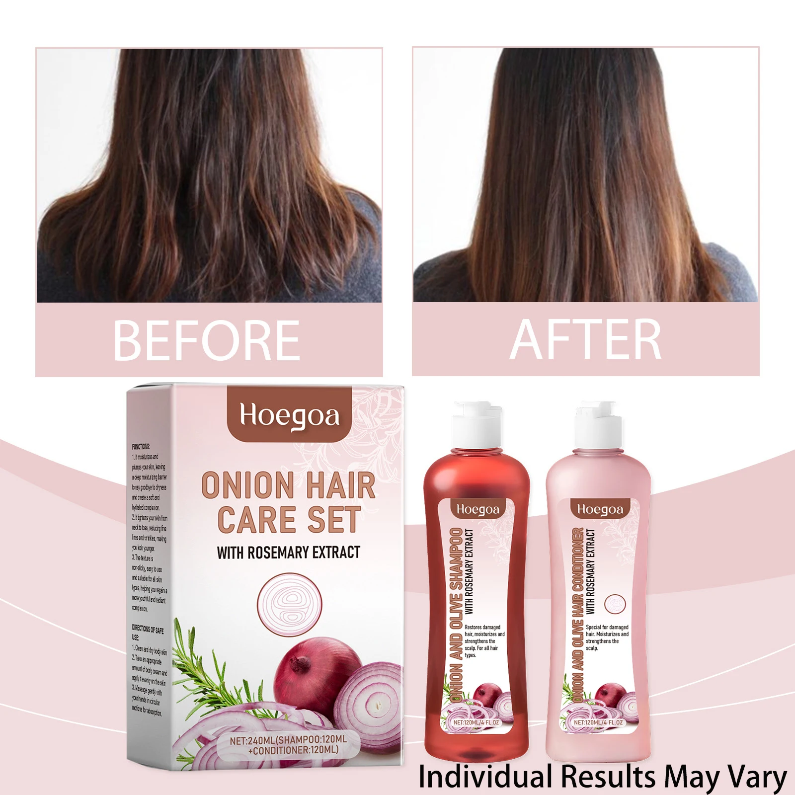 Thumbnail 2 - #30 Compare Hair Loss Treatments Before You Buy