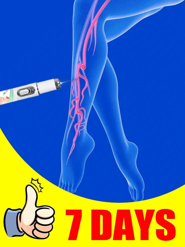 Laser Says Goodbye To Spider Legs Varicose In 7 Days