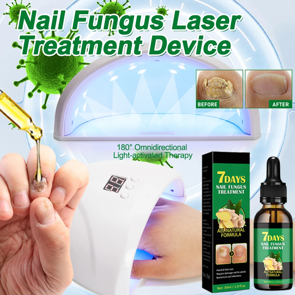 Fungal Nail Laser Device Nails Fungus Fast Repair Onychomycosis Toenail Fingernail Removes Nail Fungus Foot Care Cure Ingrown