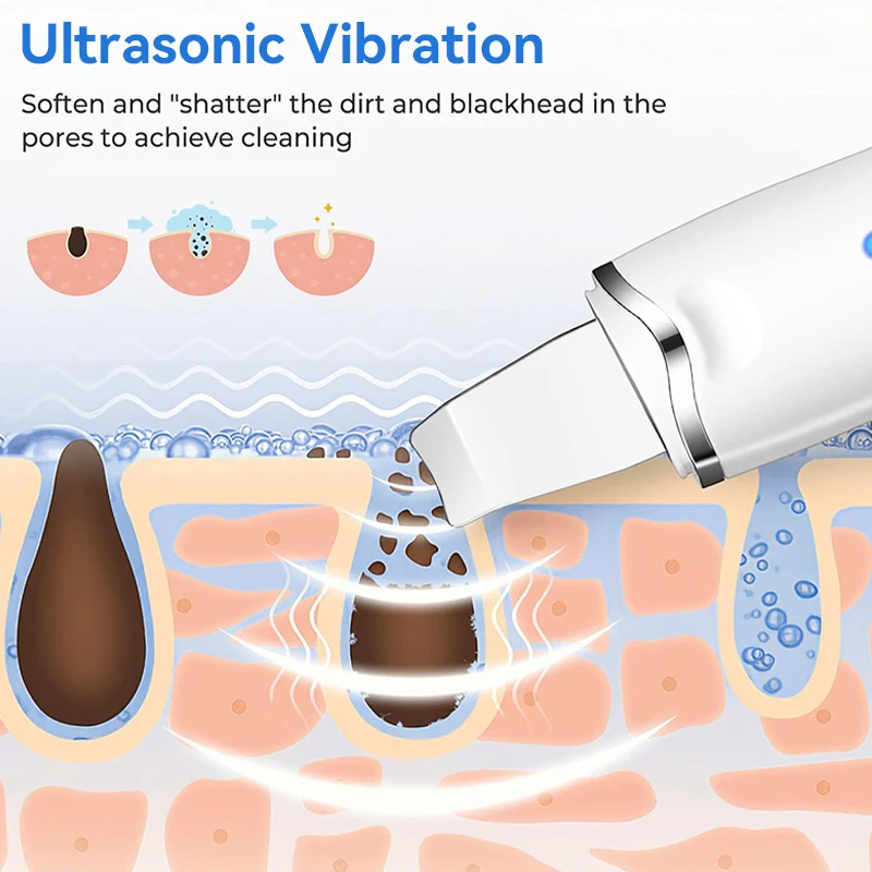 الاهتزاز الجلد الغسيل منظف للوجه مجرفة ملعقة مزيل الرؤوس السوداء المسام الأنظف تقشير مزيل الرؤوس السوداء مدلك الوجه #3