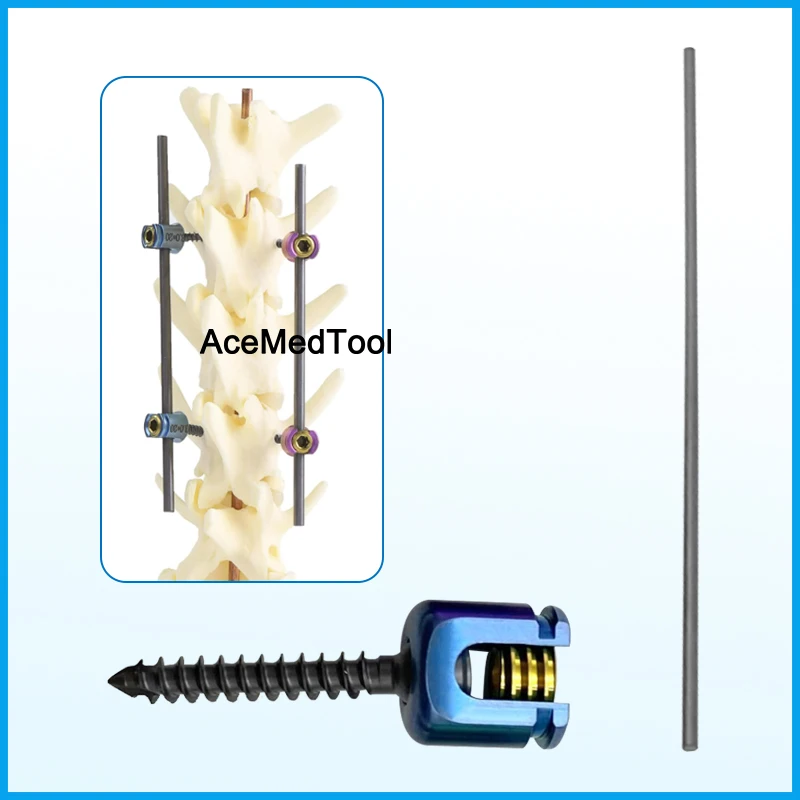 Veterinary Polyaxial Pedicle Screw Titanium Alloy Orthopedic Implant Spinal Fixation Screw for Animal Spine Orthopedic Surgery