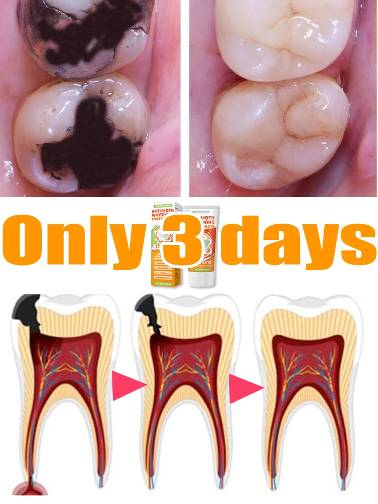 

Solve tooth decay problems and keep your teeth healthy.