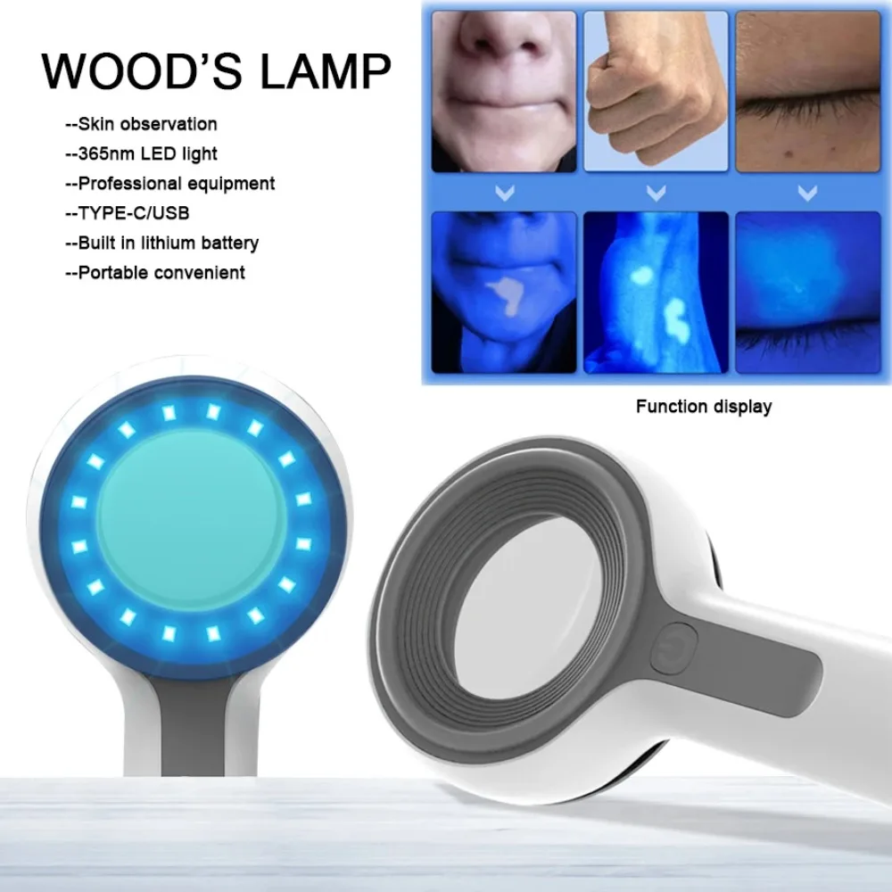 FODRK Woods Lamp UVA Lamp For Vitiligo Detection Dermatoscope Skin Medical Magnifier Detection