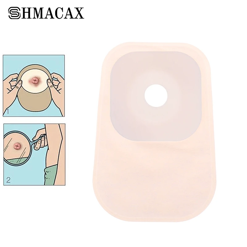 Durable System Colostomy Bags Disposable Ostomy Drainable Single Pouch Stoma Health Care Colostomy Bag Stoma Care Bags