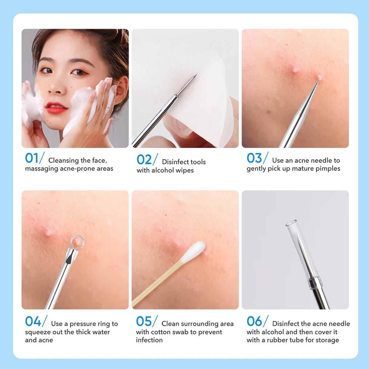 IMAGIC 4 unid/set de agujas de eliminación de espinillas y acné de acero inoxidable, limpiador de poros y manchas negras, limpiador de belleza, herramienta de cuidado de la piel facial