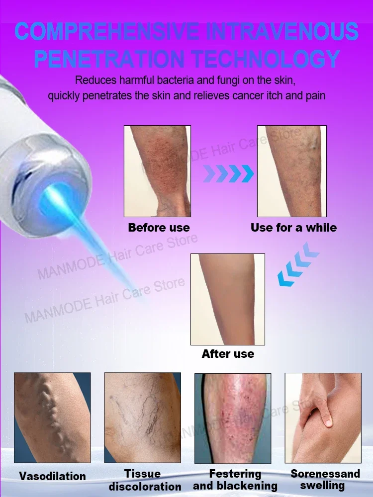 Laser Varicose Vein Products