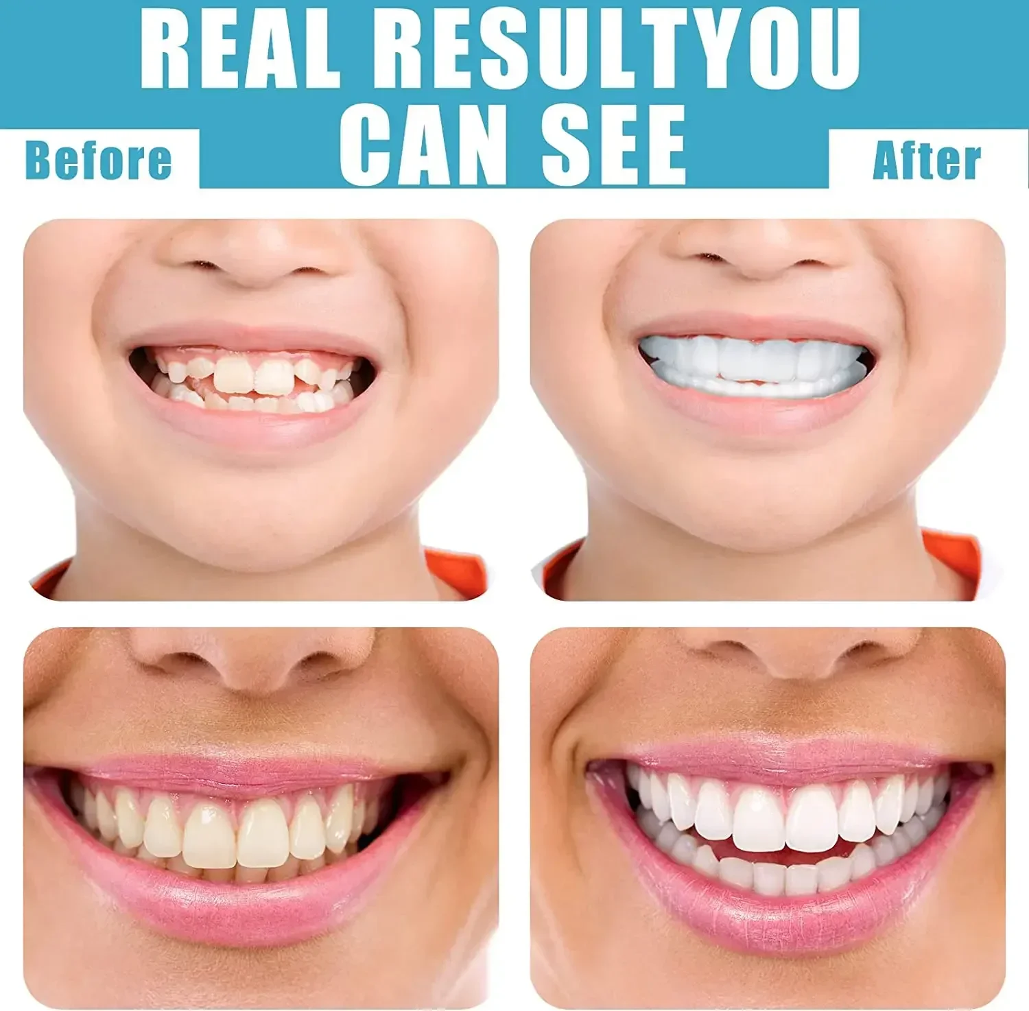 1pcs Veneers Teeth Cosmetic Teeth Temporary Smile Comfort Fit Flex Comfortable Top and Bottom Veneer Tooth