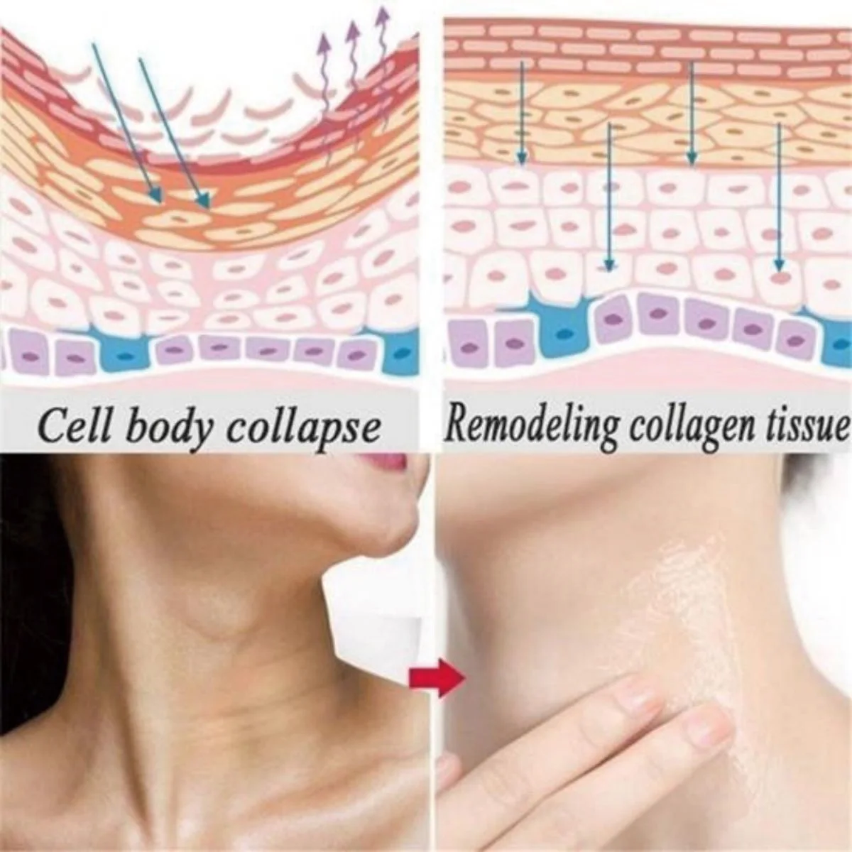 Anti-Wrinkles Cream Firming Lifting Face Neck Anti-Aging Remove Fine Lines Night Day Moisturizing Whitening Skin Care