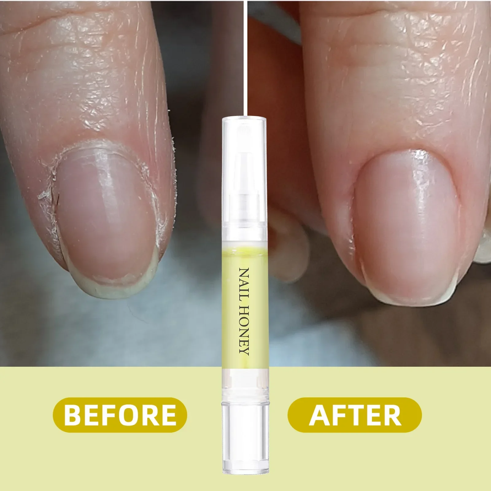 قلم زيت تغذية الأظافر تليين حماية البشرة منع Agnail جيل للأظافر البولندية علاج الأظافر إهاب تنشيط قلم زيت تغذي