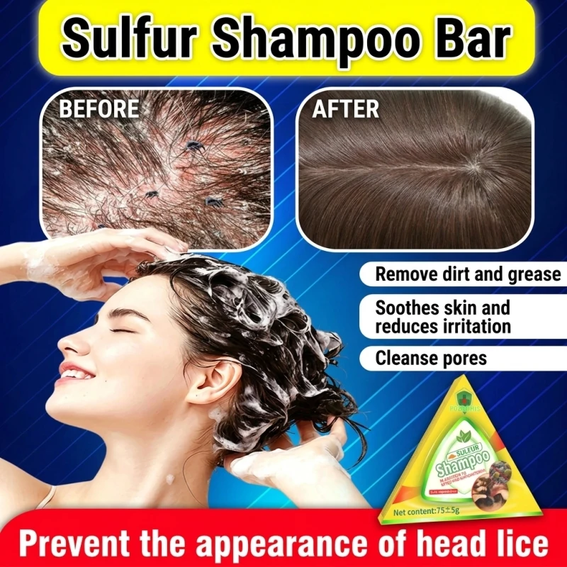 Severe Thinning Hair Awakener Solid Wash Deep Follicle Purify Scalp Detox Treatment Stubborn Bald Spot Eraser Fast Regrowth Stimulator Flake-Free Rescue Extreme Anti-Dandruff Botanical Shampoo Bar For Men Women Thicker Roots Therapy