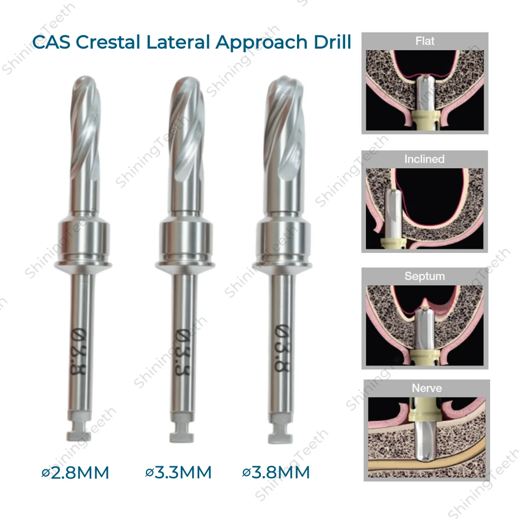 

Стоматологический хирургический инструмент: Сверло для поднятия верхнечелюстного синуса, сверло для крестального и бокового доступа к имплантату, сверло CAS