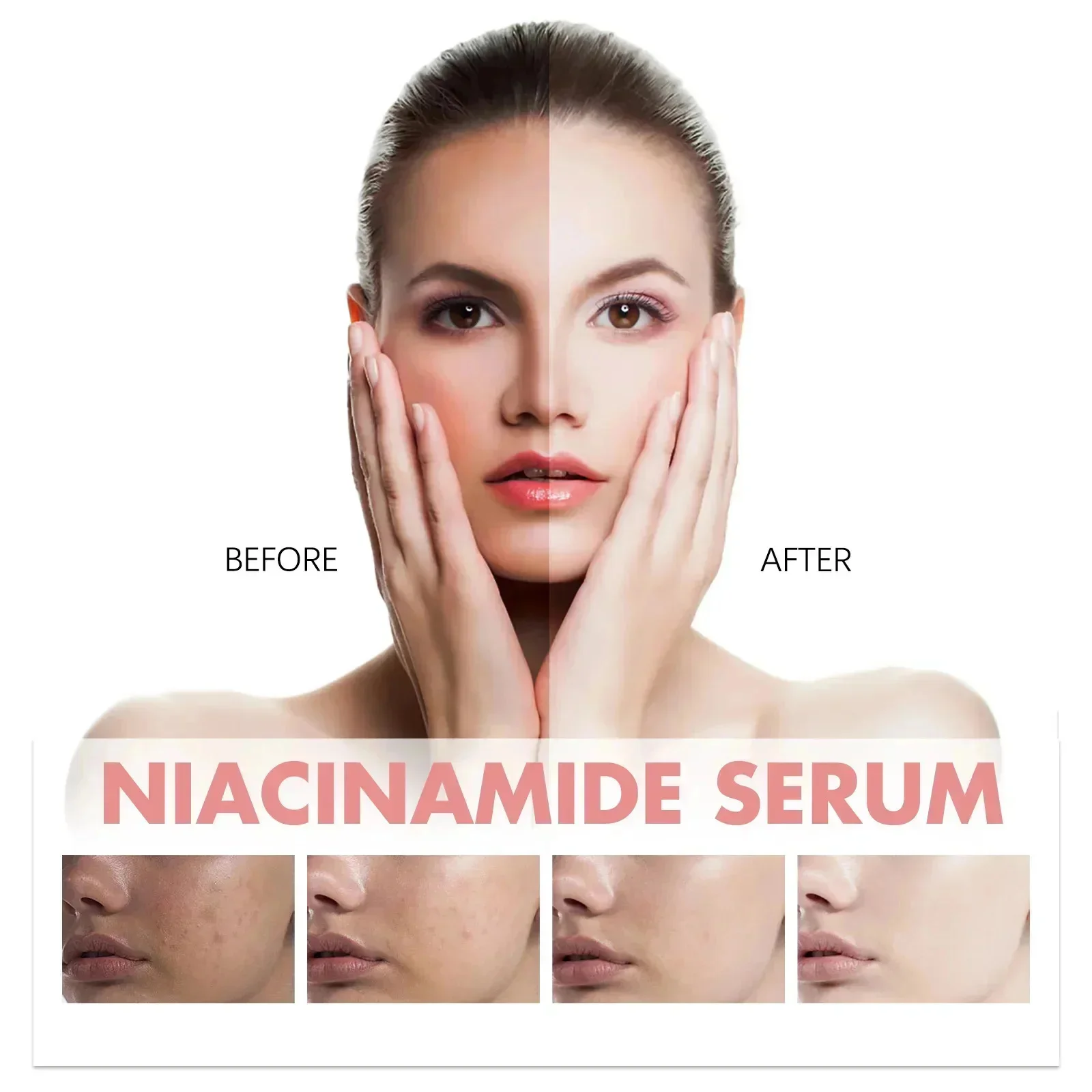 Niacinamida blanqueamiento pecas suero eliminación Melasma manchas oscuras aclara la melanina pigmentación brillo cuidado de belleza antienvejecimiento