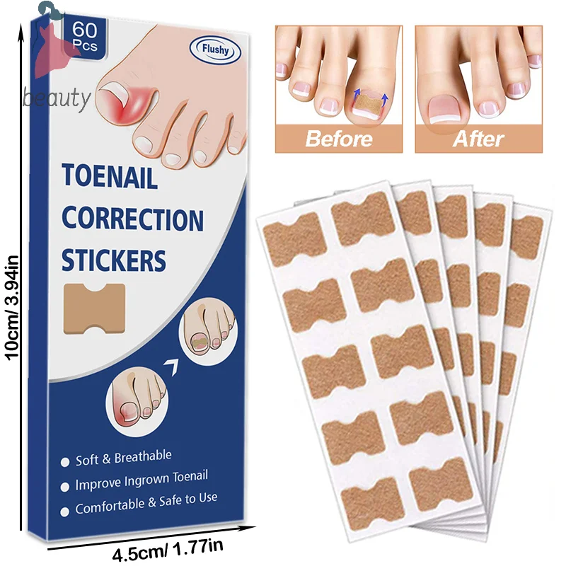 Ingrown Correção de Unhas Adesivos, Unha Corretor Patches, Tratamento Paroníquia, Recuperar, Ferramenta Pedicure Care, 60Pcs