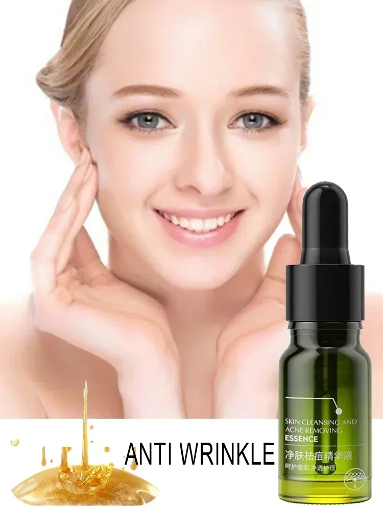 

Effective Acne Removal Comfortable Acne-removing Liquid Improve Acne Convenient Facial Repair Solution Skin Care Products Gentle