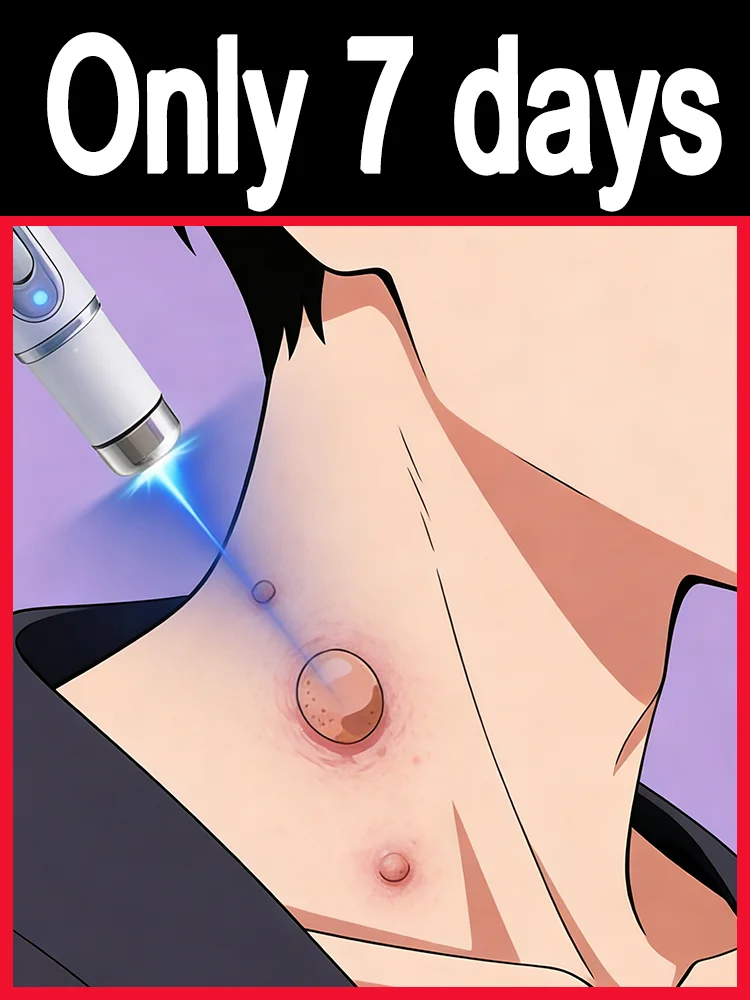 These inconspicuous little bumps not only affect ᵒⁿᵉ'ˢ ᵃᵖᵖᵉᵃʳᵃⁿᶜᵉ ᵇᵘᵗ ᵃˡˢᵒ ᶜᵃᵘˢᵉ ᵖᵃⁱⁿ