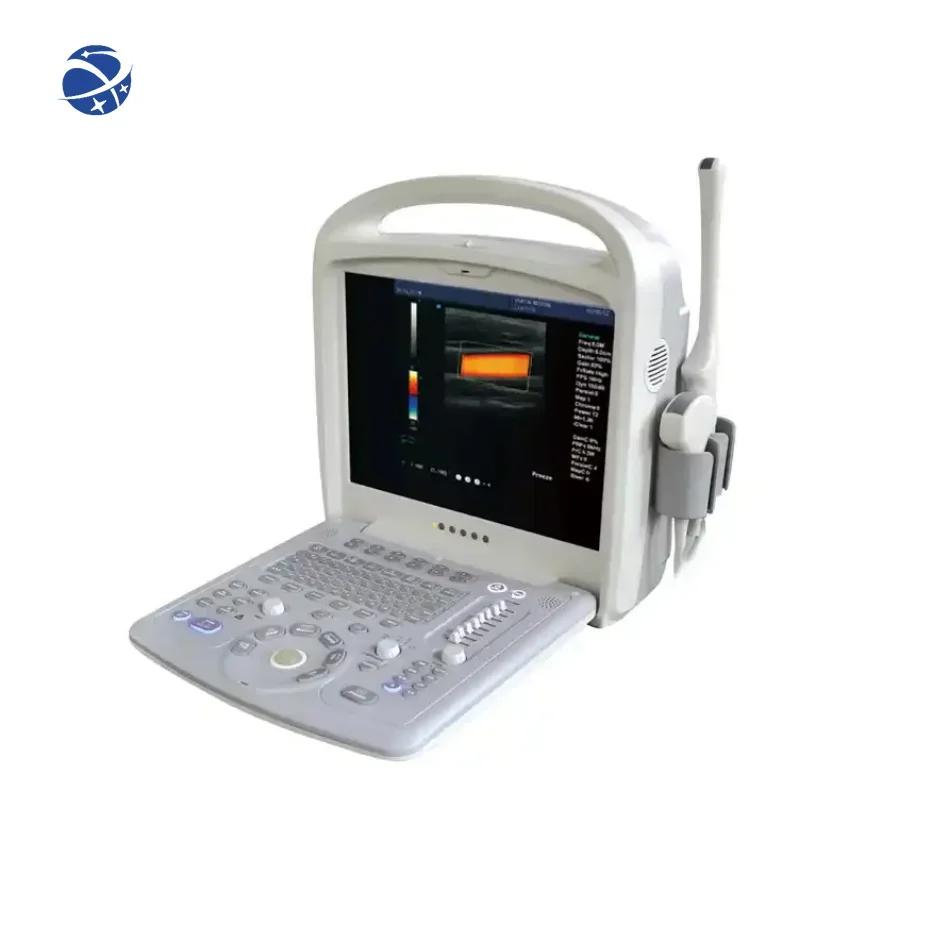 CHINCAN C60 Portable Color Doppler Ultrasound Diagnostic System Machine