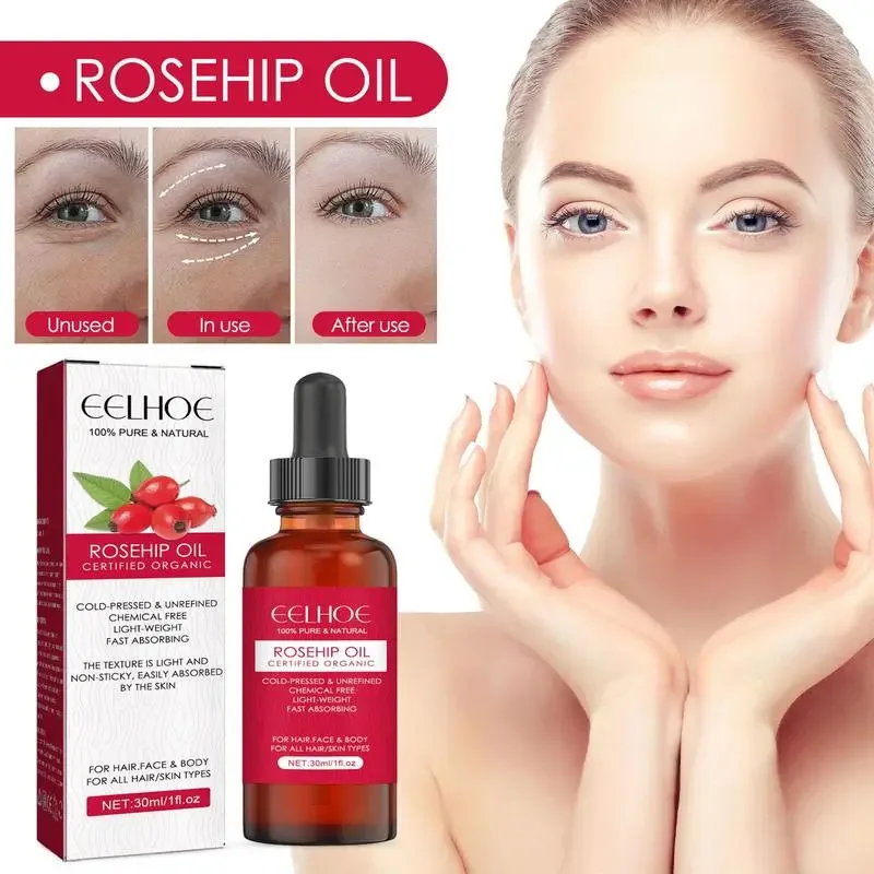 30ml Organic Rosehip Seed Oil For Face Pure Cold Pressed Facial Oil Natural Moisturizing Skin Care Serum For Scars Stretch Marks