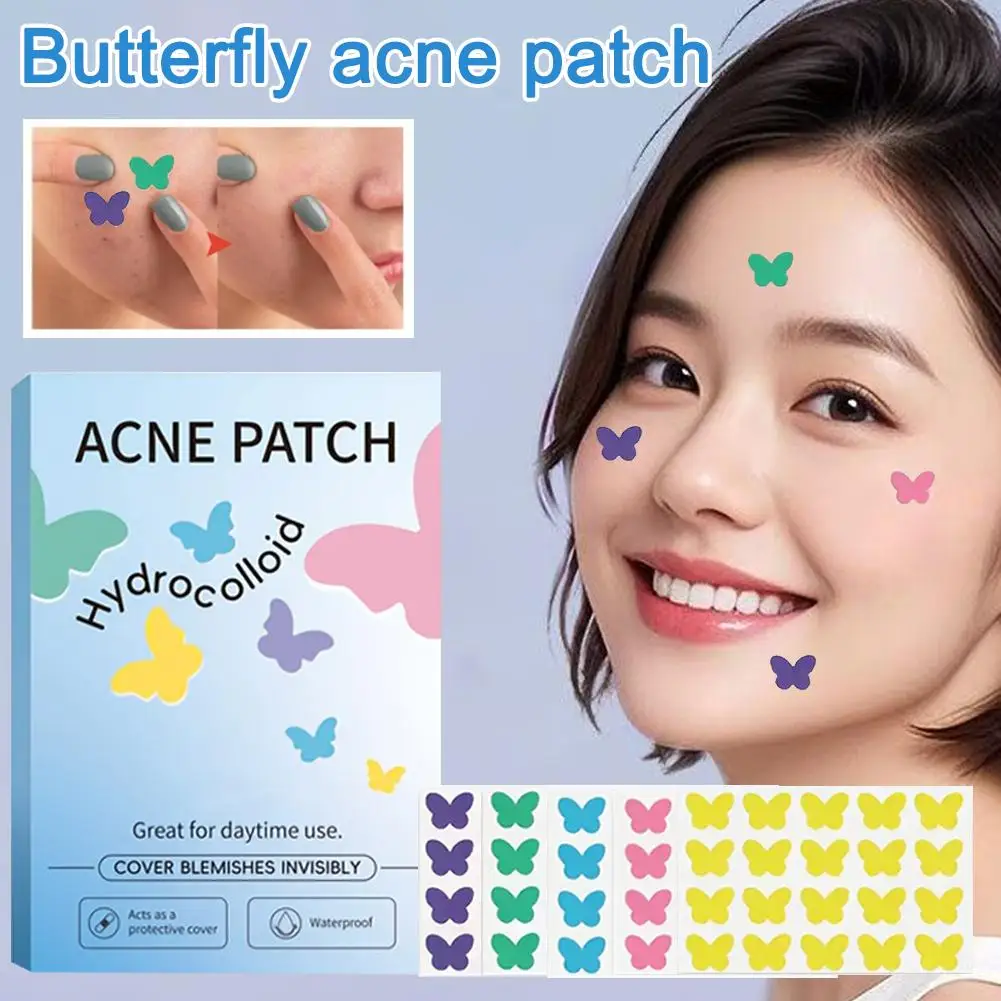 100 قطعة فراشة بثرة التصحيح PE حب الشباب ملصق معتدل غير مزعجة يضيء حب الشباب لبقع الوجه Zits الجمال ماكياج أداة 2026 جديد #4
