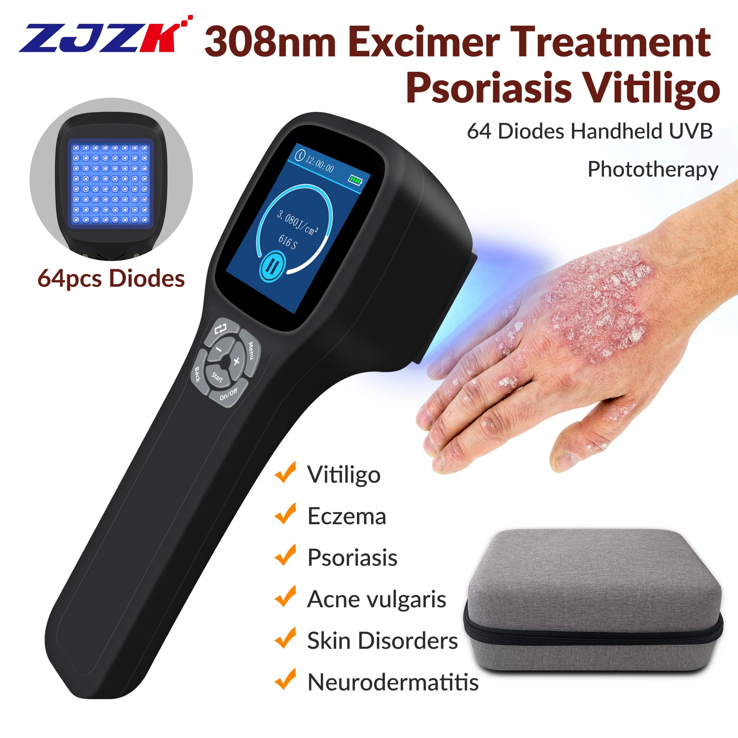 2026 ZJZK UV Phototherapy Best 308nm Excimer UVB Light Lamp for Psoriatic Arthritis Eczema Ultraviolet Therapy Treatment at Home