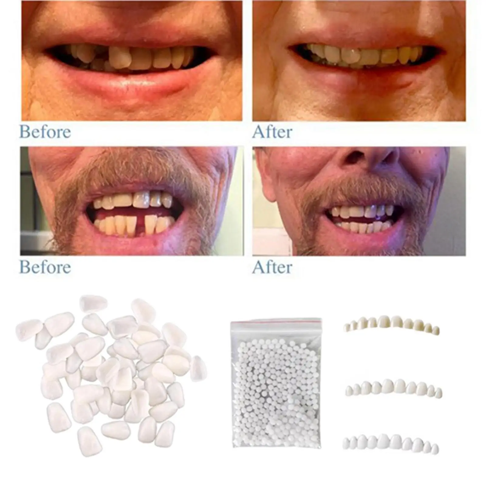 

Зубные виниры для отбеливания, обучения, временные поддельные зубы, уверенность, улыбка