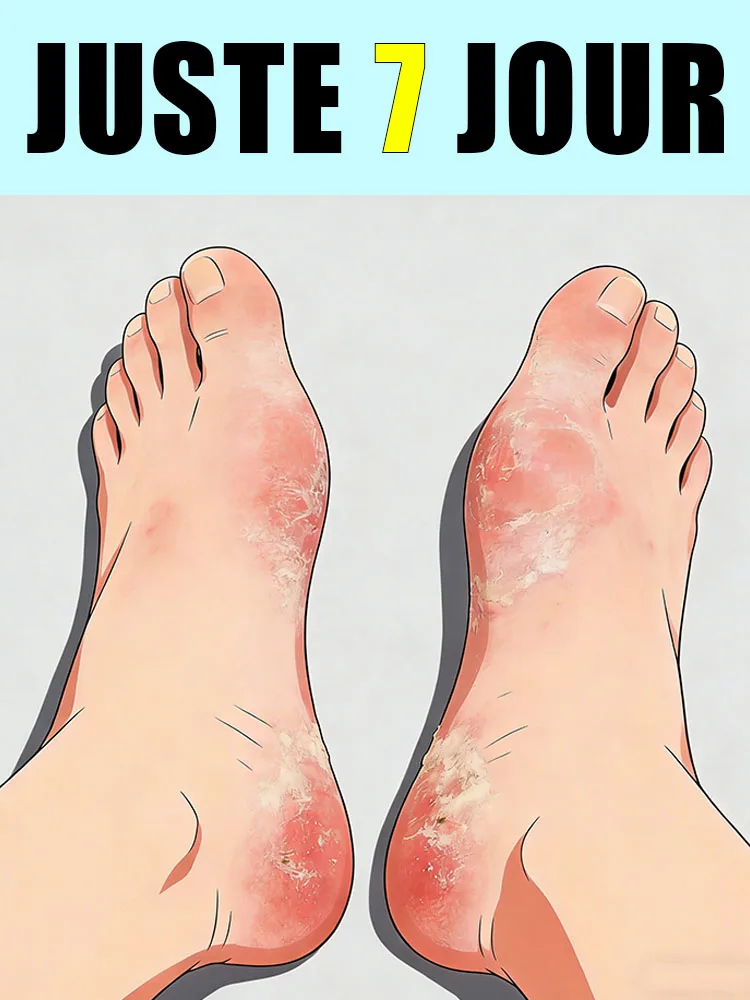 Rendez tertpe plus Facile et Plus bequem, und Dites Adieu à l'inconfort.