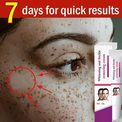 Remove Dark Spots Whitening Freckle Effective Remove Melasma Melanin Moisturize Brighten Smooth Face Skin Care