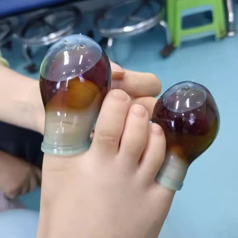 1 peça de protezioni para le dita dei piedi em silicone morbido, reduz a frição prevém inserimento delle unghie per la c