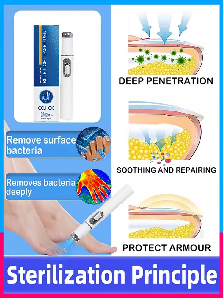 2‑in‑1 Nail Care Set, Blue Light Pen & Nail Repair Oil, Home Nail Conditioning Kit for Discolored Thickened Nails