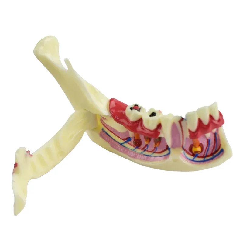 

Teaching Model Mandibular Dental Endodontic Teeth Demonstration Anatomical Patient Model Materials Dentistry