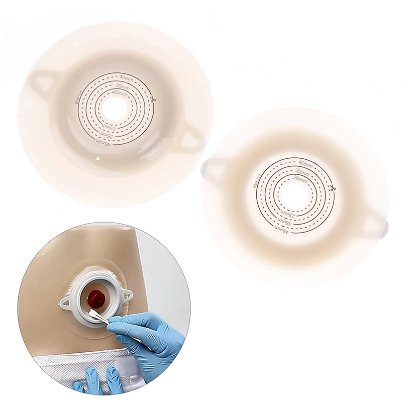 Disposable Ostomy Belt Baseplates Colostomy Bags Two-Piece System Stoma Base Plate Soft Touch Shear Hole 20-40mm