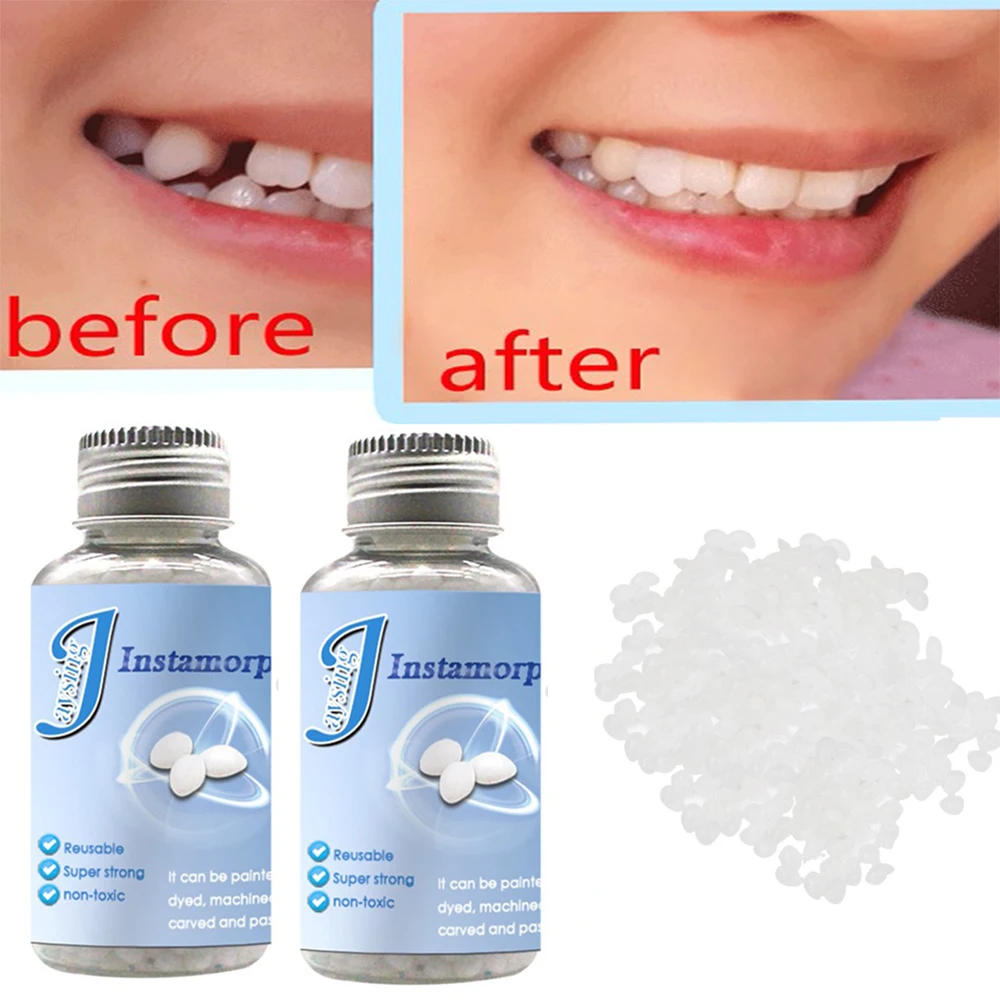 Denture Repair Dental Temporary Tooth Filling Material Tooth Replacement Material Denture Solid Tooth Gel Tooth Repair Kit