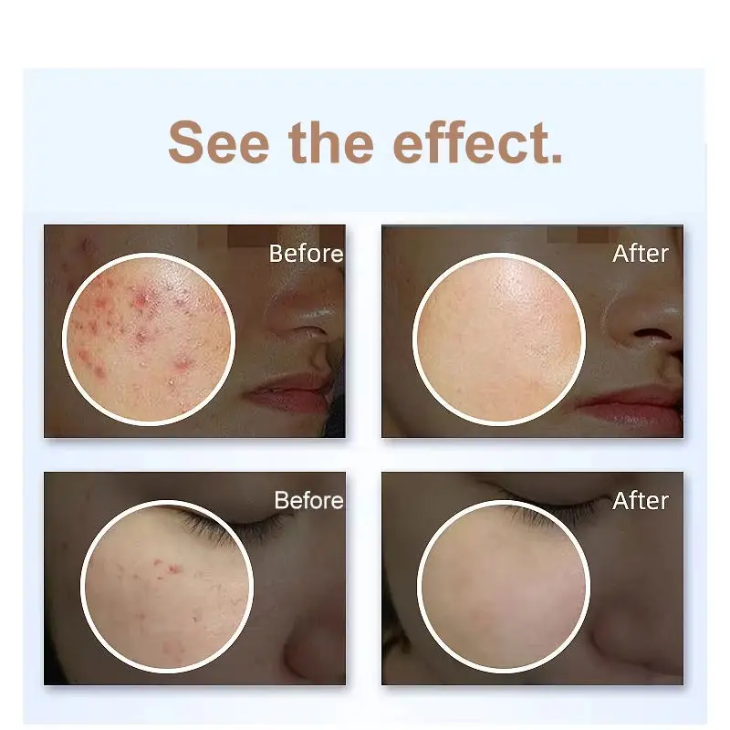 携帯型プラズマ美容器 O3 デイリーメンテナンス アンチエイジング EMS マイクロカレント オゾン レッドライト 抗菌 ダニ除去