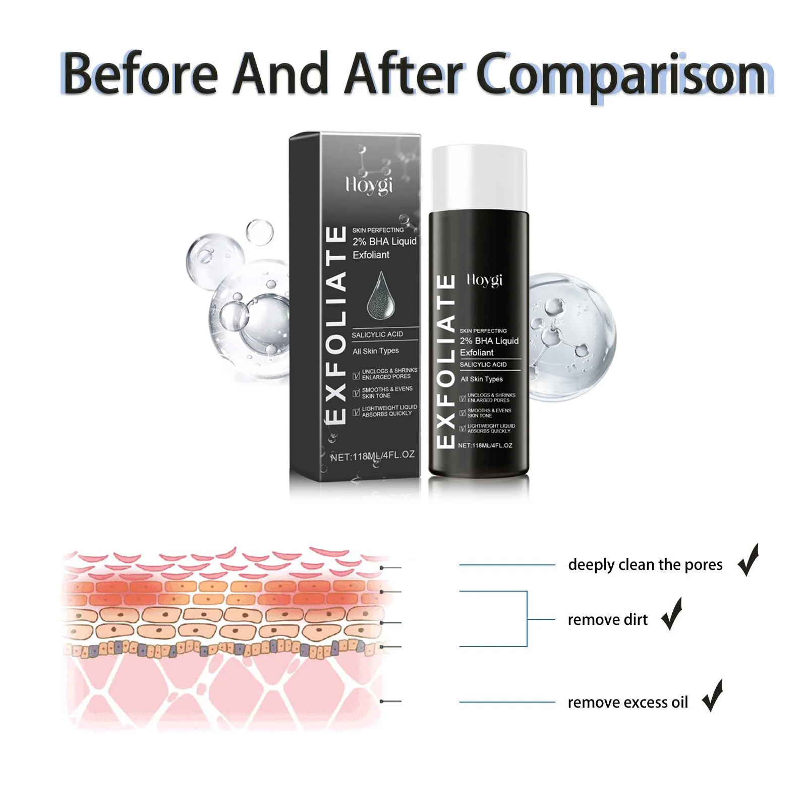 2% BHA حمض الساليسيليك السائل مقشر الوجه-تقليل البثور مصحح البقع الداكنة تقليل المسام ترطيب تنعيم #3