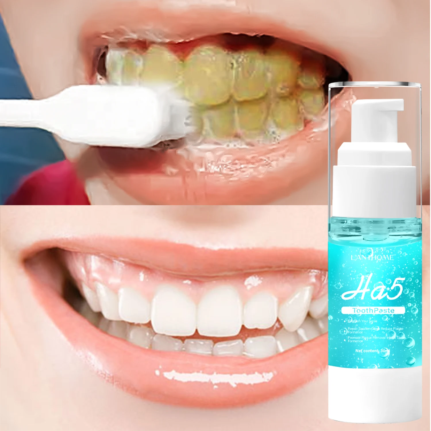 Dentifrice blanchissant pour les dents à l'acide hyaluronique, réparation gingivale, traitement buccal, plaque jaune remodelée, HA5, tout neuf, 30ml