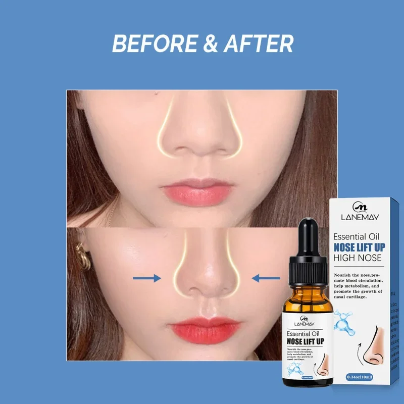 10ml Nose Lift Up Essential Oil Heighten Rhinoplasty Oil Nose Up Heighten Rhinoplasty Pure Natural Care Thin Smaller Nose