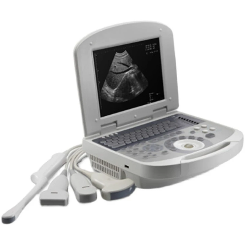 Notebook medical B-ultrasound portable black-and-white high-definition B-ultrasound