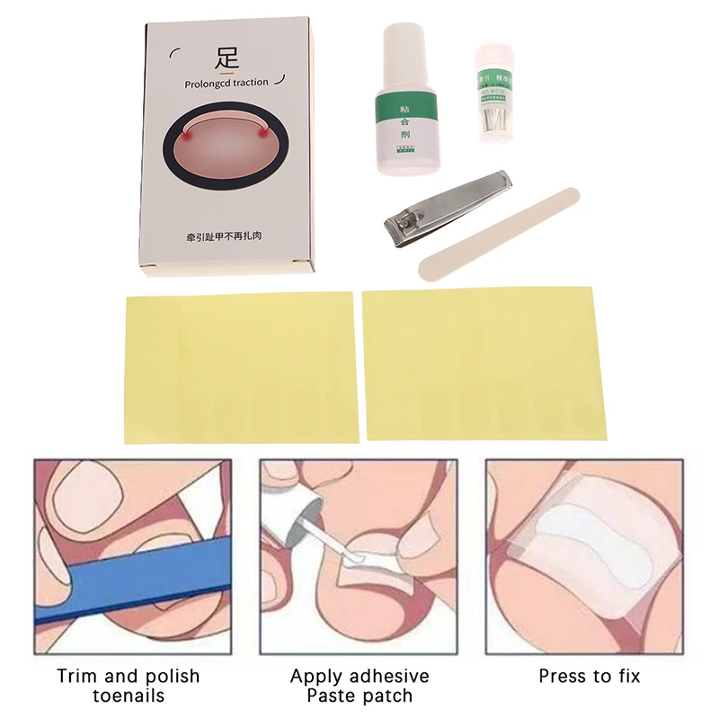 Ingrown Toenail Correction Tool Ingrown Toe Nail Treatment Elastic Patch Sticker Straightening Clip Brace Pedicure Tool