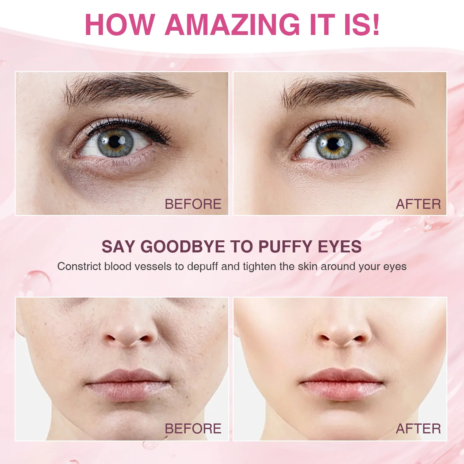 Multifunction Skincare Device Face Radio Frequency with Hot Cold Facial Lifting Deep Electric  Skin Beauty Care Devices