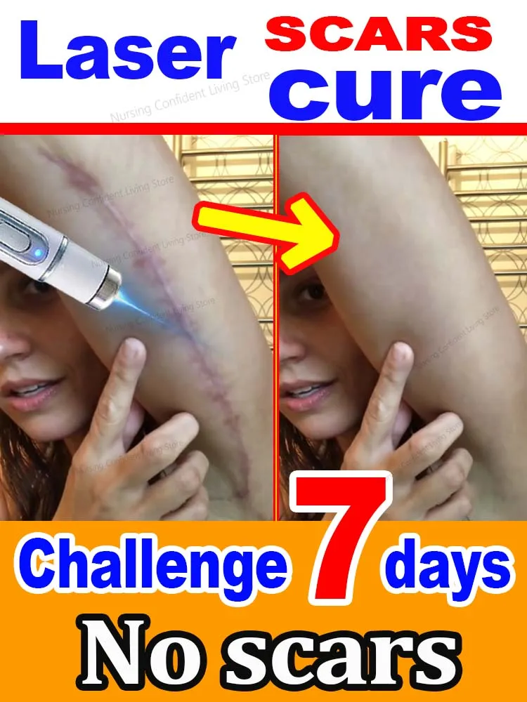 

No scars, smooth skin
