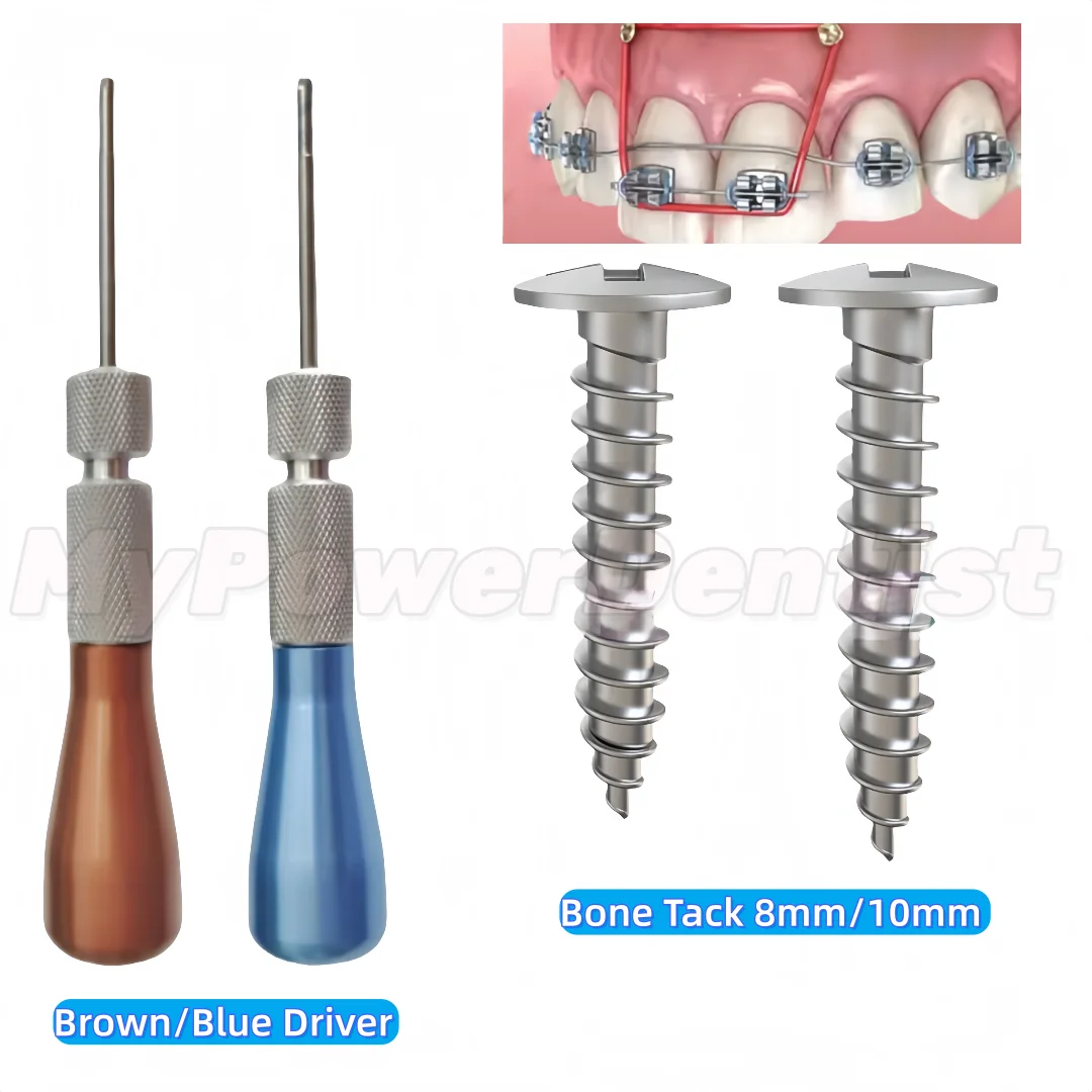 

Dental Bone Screw GBR Tent Screw Full/Half Thread TC4 Screw 8/10mm Driver