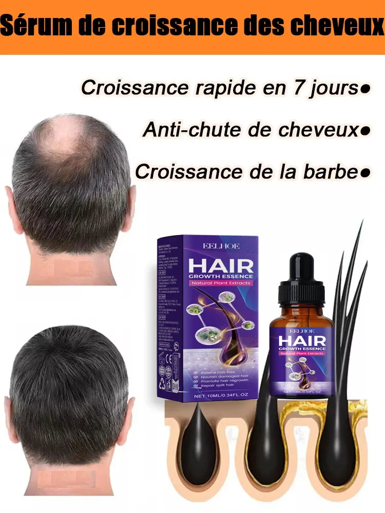 

99% of buyers buy again, have more and more hair, say goodbye to baldness, thick hair,Hot selling product