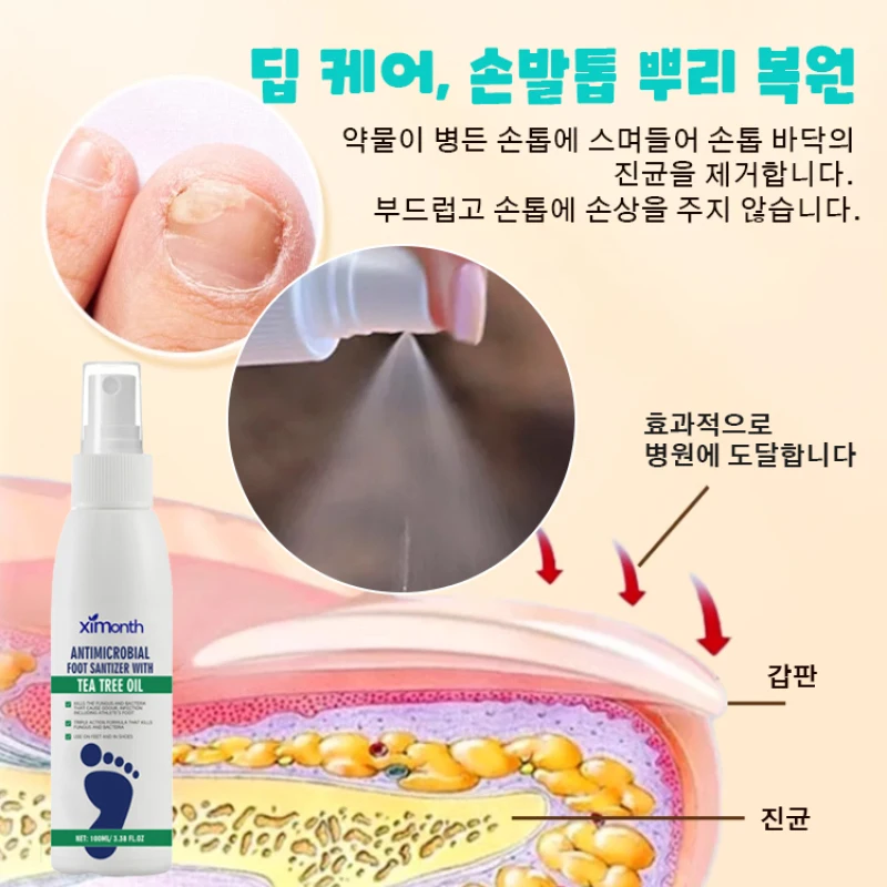 Foot Cream Foot Care Dboard Heel-hydrate Dehydrate Deodorization Pair Foot spray to remove fungus Foot spray Medical gyong fungus removal foot spray New