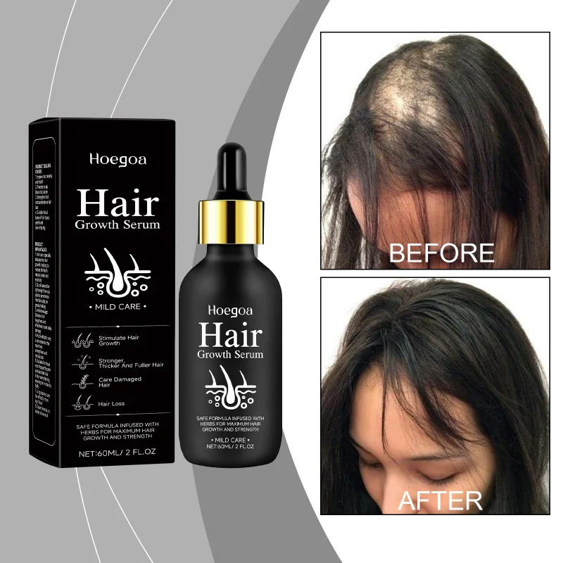 

Hair Strengthening Serum, Scalp Nourishing Treatment For Fuller Looking Hair, Daily Use Hair Growth Care Essence