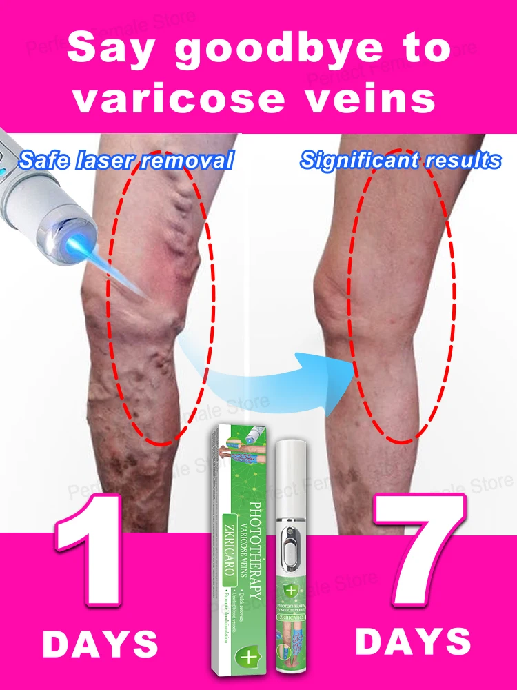 vein laser product